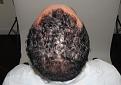 Click image for larger version

Name:	jz 1 year post-op chin up.jpg
Views:	276
Size:	91.3 KB
ID:	485658