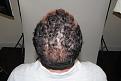 Click image for larger version

Name:	jz 1 year post-op crown (2).jpg
Views:	304
Size:	87.9 KB
ID:	485662