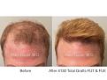 Click image for larger version

Name:	4130 FUT:FUE.001.jpg
Views:	488
Size:	13.3 KB
ID:	485784