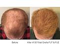 Click image for larger version

Name:	4130 FUT:FUE.002.jpg
Views:	614
Size:	15.9 KB
ID:	485785
