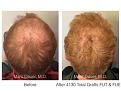 Click image for larger version

Name:	4130 FUT:FUE.005.jpg
Views:	453
Size:	16.9 KB
ID:	485788