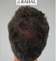 Click image for larger version

Name:	L5.jpg
Views:	326
Size:	9.5 KB
ID:	485826
