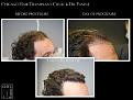 Click image for larger version

Name:	Slide3.jpg
Views:	296
Size:	61.2 KB
ID:	485839