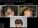 Click image for larger version

Name:	Slide5.jpg
Views:	292
Size:	64.3 KB
ID:	485841