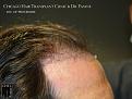 Click image for larger version

Name:	Slide14.jpg
Views:	299
Size:	65.1 KB
ID:	485850