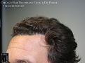 Click image for larger version

Name:	Slide18.jpg
Views:	305
Size:	71.1 KB
ID:	485854