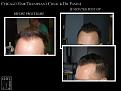 Click image for larger version

Name:	Slide1.JPG
Views:	276
Size:	86.1 KB
ID:	486057