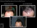 Click image for larger version

Name:	Slide2.jpg
Views:	273
Size:	60.6 KB
ID:	486058