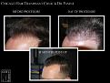 Click image for larger version

Name:	Slide4.jpg
Views:	270
Size:	65.2 KB
ID:	486060