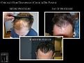 Click image for larger version

Name:	Slide5.jpg
Views:	269
Size:	63.3 KB
ID:	486061