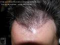 Click image for larger version

Name:	Slide11.jpg
Views:	267
Size:	94.4 KB
ID:	486067
