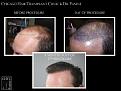 Click image for larger version

Name:	Slide4.jpg
Views:	196
Size:	63.7 KB
ID:	486153