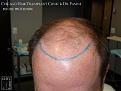 Click image for larger version

Name:	Slide6.jpg
Views:	186
Size:	60.4 KB
ID:	486155