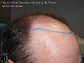 Click image for larger version

Name:	Slide7.jpg
Views:	188
Size:	75.3 KB
ID:	486156