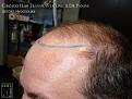 Click image for larger version

Name:	Slide8.jpg
Views:	180
Size:	81.6 KB
ID:	486157