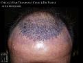 Click image for larger version

Name:	Slide9.jpg
Views:	191
Size:	79.6 KB
ID:	486158
