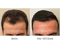 Click image for larger version

Name:	1972 Grafts FUT.001.jpg
Views:	291
Size:	12.8 KB
ID:	486172