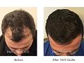 Click image for larger version

Name:	1972 Grafts FUT.004.jpg
Views:	307
Size:	16.1 KB
ID:	486173