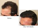 Click image for larger version

Name:	1972 Grafts FUT.002.jpg
Views:	292
Size:	11.8 KB
ID:	486174
