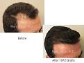 Click image for larger version

Name:	1972 Grafts FUT.003.jpg
Views:	280
Size:	11.9 KB
ID:	486175