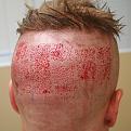 Click image for larger version

Name:	unnamed-5.jpg
Views:	328
Size:	57.8 KB
ID:	486228