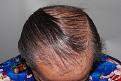 Click image for larger version

Name:	jo before chin down.jpg
Views:	256
Size:	97.1 KB
ID:	486238