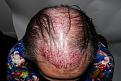Click image for larger version

Name:	jo imm post chin down.jpg
Views:	244
Size:	97.0 KB
ID:	486239