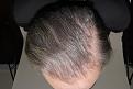Click image for larger version

Name:	jo 1 year post chin down.jpg
Views:	252
Size:	95.5 KB
ID:	486240