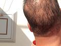 Click image for larger version

Name:	IMG_3207.jpg
Views:	377
Size:	91.1 KB
ID:	486348