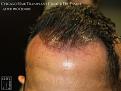 Click image for larger version

Name:	Slide9.jpg
Views:	255
Size:	68.4 KB
ID:	486395