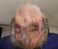 Click image for larger version

Name:	lk before chin up.jpg
Views:	225
Size:	95.0 KB
ID:	486438