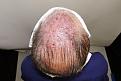 Click image for larger version

Name:	lk immediate post-op chin up.jpg
Views:	220
Size:	94.7 KB
ID:	486439