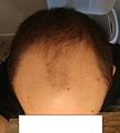 Click image for larger version

Name:	3.jpg
Views:	261
Size:	80.1 KB
ID:	486445