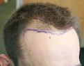 Click image for larger version

Name:	unnamed-1.jpg
Views:	251
Size:	54.7 KB
ID:	486595