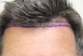 Click image for larger version

Name:	pre-op (9).jpg
Views:	309
Size:	86.4 KB
ID:	486611