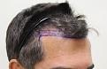 Click image for larger version

Name:	pre-op (12).jpg
Views:	310
Size:	86.8 KB
ID:	486612