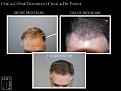 Click image for larger version

Name:	Slide2.JPG
Views:	288
Size:	93.4 KB
ID:	486708
