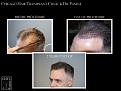 Click image for larger version

Name:	Slide4.JPG
Views:	290
Size:	89.4 KB
ID:	486710