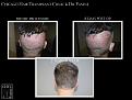Click image for larger version

Name:	Slide5.JPG
Views:	294
Size:	90.7 KB
ID:	486711