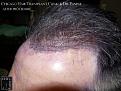Click image for larger version

Name:	Slide13.jpg
Views:	290
Size:	94.6 KB
ID:	486718