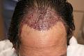 Click image for larger version

Name:	jg imm post chin down.jpg
Views:	247
Size:	91.0 KB
ID:	486755