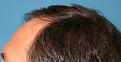 Click image for larger version

Name:	jg before L profile.jpg
Views:	228
Size:	97.1 KB
ID:	486757