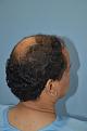 Click image for larger version

Name:	Darling Buds Hair Transplant Clinic (6).jpg
Views:	251
Size:	95.4 KB
ID:	487055
