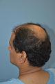 Click image for larger version

Name:	Darling Buds Hair Transplant Clinic (7).jpg
Views:	255
Size:	92.7 KB
ID:	487056