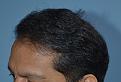 Click image for larger version

Name:	Darling Buds Hair Transplant Clinic (10).jpg
Views:	269
Size:	94.2 KB
ID:	487058