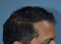 Click image for larger version

Name:	Darling Buds Hair Transplant Clinic (11).jpg
Views:	275
Size:	96.3 KB
ID:	487059