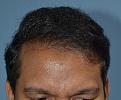 Click image for larger version

Name:	Darling Buds Hair Transplant Clinic (12).jpg
Views:	291
Size:	94.6 KB
ID:	487060