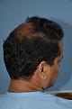 Click image for larger version

Name:	Darling Buds Hair Transplant Clinic (14).jpg
Views:	266
Size:	96.3 KB
ID:	487062