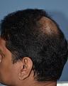 Click image for larger version

Name:	Darling Buds Hair Transplant Clinic (15).jpg
Views:	269
Size:	93.7 KB
ID:	487063