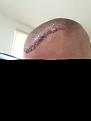 Click image for larger version

Name:	FUE POD 2.jpg
Views:	201
Size:	86.8 KB
ID:	487117